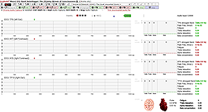 4 Channel EEG Recording for Muse S Head Band incl. Brain Synthesizer/Sampler